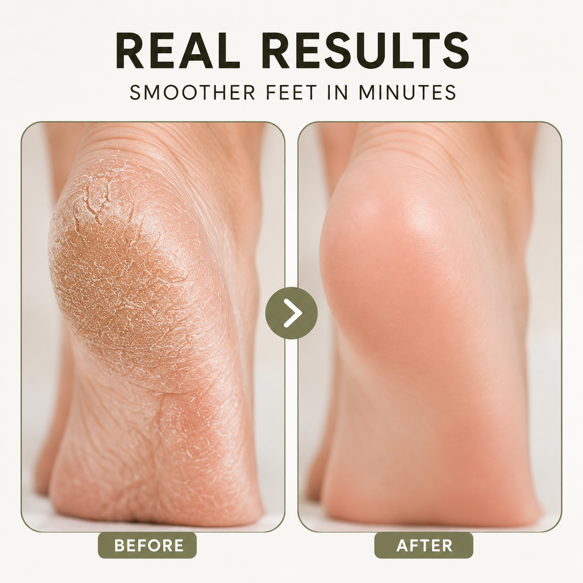 SoftSole™Manual Foot Filer